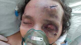 Paciente ficou com o rosto desfigurado após acidente dentro de hospital particular. (Foto: Direto das Ruas)