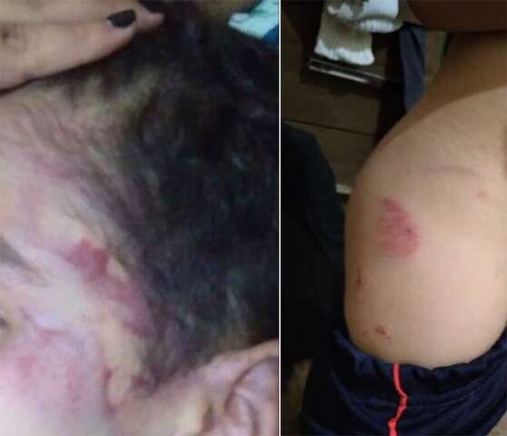 Justi&ccedil;a mant&eacute;m pris&atilde;o de lutador de muay thai que espancou enteado