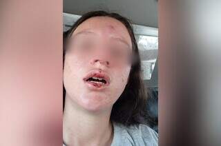 Vítima com o rosto machucado após ser agredida no estabelecimento. (Foto: Direto das Ruas)
