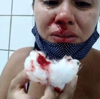 Dona de casa termina com nariz sangrando após teste de covid em posto de saúde