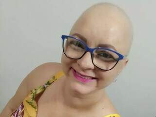 Letícia perdeu os cabelos durante o tratamento de câncer. (Foto: Arquivo Pessoal)