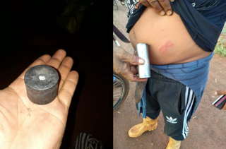 Índio mostra ferimento causado por bala de borracha (Foto: reprodução/Cimi)