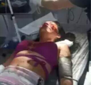Mulher ferida com cortes de garrafa em Sidrolândia. (Foto: Direto das Ruas)