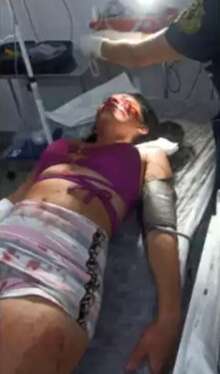 Mulher apanha e leva &quot;garrafadas&quot; no rosto durante confus&atilde;o em Sidrol&acirc;ndia