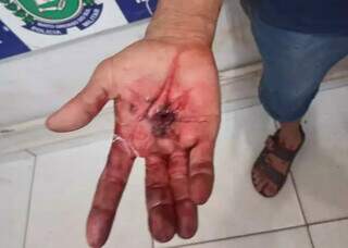 José só soltou a arma depois que foi ferido na mão pelos policiais que atenderam a ocorrência (Foto: Divulgação PM de Três Lagoas)