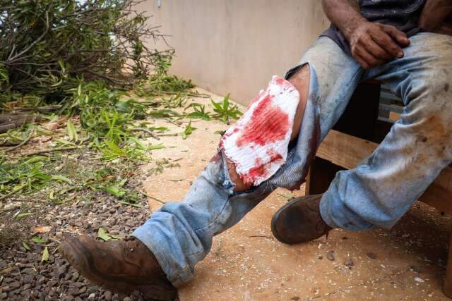 Homem sofre corte e exposi&ccedil;&atilde;o do osso do joelho ap&oacute;s motosserra cair em perna