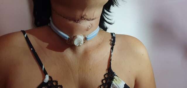 &ldquo;Ele achou que tinha me matado&rdquo;: v&iacute;tima de estupro narra momentos de horror