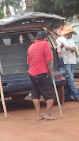 Homem teve pele do rosto arrancada ap&oacute;s ser atacado por pitbull 