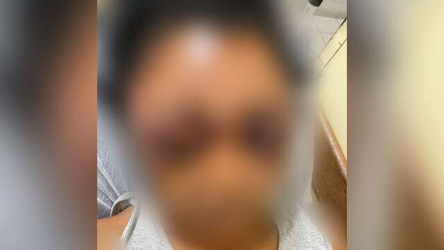 Espancada e arrastada pelo marido, mulher tem afundamento de cr&acirc;nio