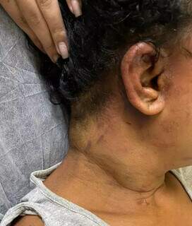 Mulher sofreu vários ferimentos na região da cabeça (Foto: Direto das Ruas)