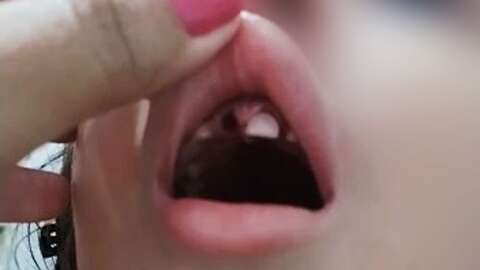 Criança de 4 anos tem dente arrancado em brinquedo de shopping 