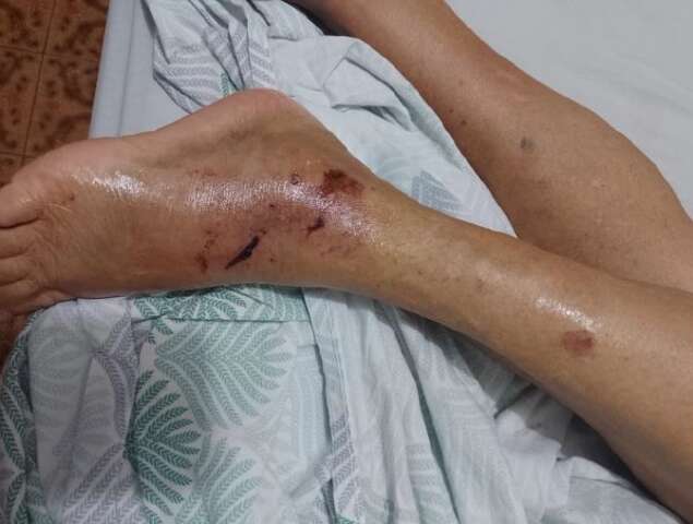 Idosa prensada em elevador pede indeniza&ccedil;&atilde;o de R$ 100 mil devido sequelas
