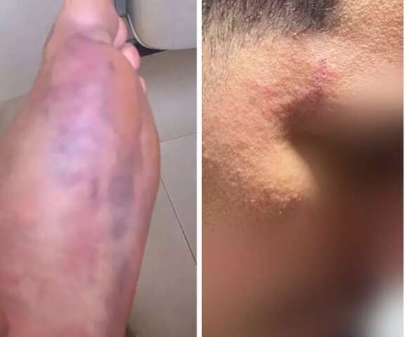 Trabalhador acusa pol&iacute;cia de tortura ao ser confundido com ladr&atilde;o de condom&iacute;nios