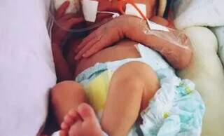 Bebê prematuro em Unidade de Terapia Intensiva de hospital. (Foto: Divulgação HRMS)