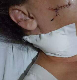 Audineth no hospital se recuperando dos ferimentos que sofreu durante tentativa de roubo. (Foto: Direto das Ruas)
