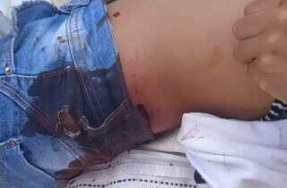 Outra vítima, mulher de 22 anos, foi baleada no abdome e transferida para Ponta Porã. (Foto: Cimi)