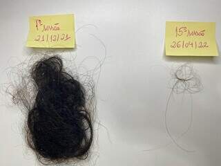 Início de tratamento com queda de cabelos intensa após covid e o resultado após 15 sessões. (Foto: Divulgação)