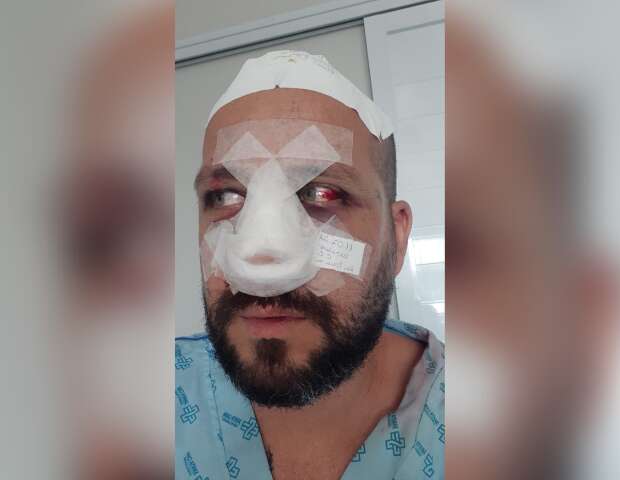 &ldquo;N&atilde;o achei que ia sobrar pra mim&rdquo;, diz motorista agredido por 3 homens 