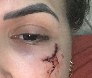&ldquo;Inconsciente em po&ccedil;a de sangue&rdquo;, estudante denuncia ex-namorado por viol&ecirc;ncia  