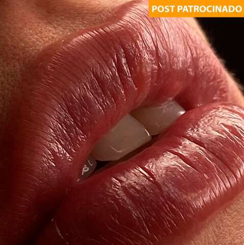 Especialistas em harmonização orofacial buscam pacientes modelos