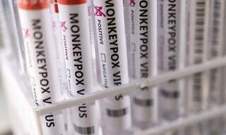 Tubos de exames para confirmação da varíola do macaco. (Foto: Agência Brasil) -