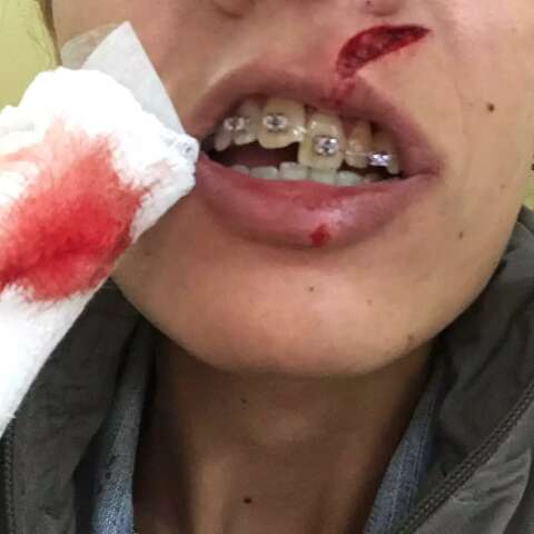 M&uacute;sica de Eduardo Costa &eacute; estopim para briga e dois dentes afundados