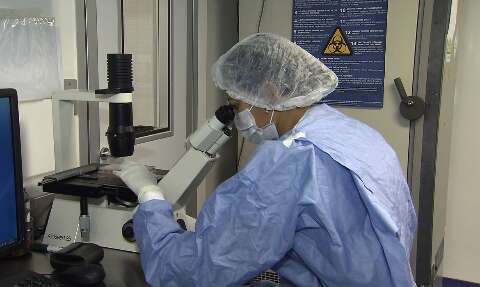 Laboratório do Rio investiga suspeita de morte por varíola dos macacos em MS