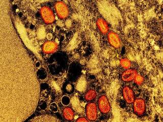 Micrografia eletrônica de transmissão colorida de partículas de varíola de macaco (laranja). (Foto Pública/NIAID)