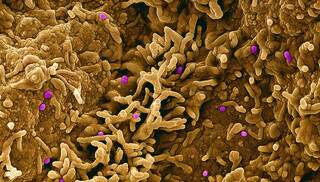 Partículas de varíola de macaco encontradas dentro de uma célula infectada. (Foto: Agência Foto Pública/NIAID)