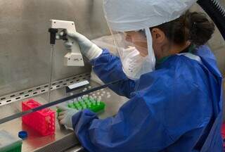 Teste sendo realizado em laboratório. (Foto: CDC/Pexels)