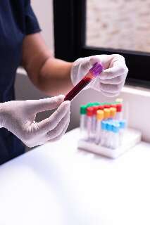 Brasil faz 8.850 testes de varíola dos macacos
