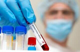 Teste sanguíneo para identificar a varíola dos macacos (Foto: Shutterstock)