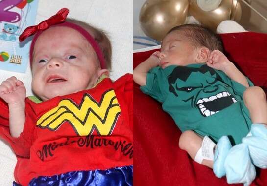 Na luta pela vida, super-heróis prematuros festejam "mesversário"  