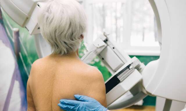Exames de mamografia e papanicolau gratuitos ser&atilde;o oferecidos na UFGD 