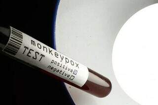 Teste em laboratório para casos de Monkeypox (Foto: Reprodução)