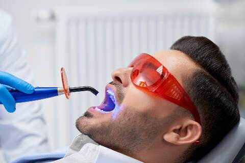 Clareamento dentário tem limite?