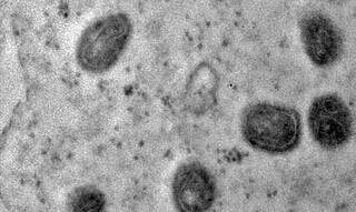 Amostra do vírus Monkeypox vista pelas lentes de um microscópio. (Foto: IOC/Fiocruz)