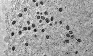 Amostra da coleta do vírus varíola dos macacos vista por microscópio (Foto: Débora F. Barreto-Vieira/IOC/Fiocruz)