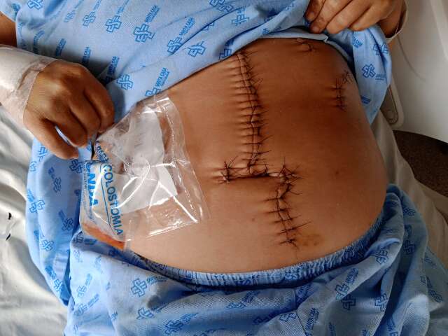&ldquo;Depois de 6 meses ele j&aacute; come&ccedil;ou a me bater&rdquo;, conta mulher esfaqueada pelo ex