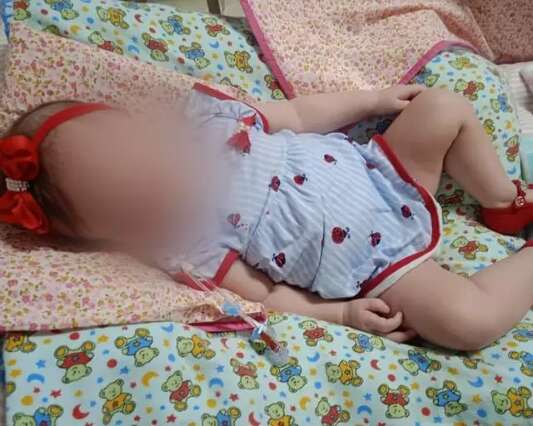 Kaya, bebê que não sorri, precisa de ajuda para tratamento no cérebro