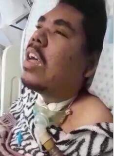 Mãe pede ajuda para filho que tem microcefalia e se alimenta por sonda Mãe pede ajuda para filho que tem microcefalia e se alimenta por sonda