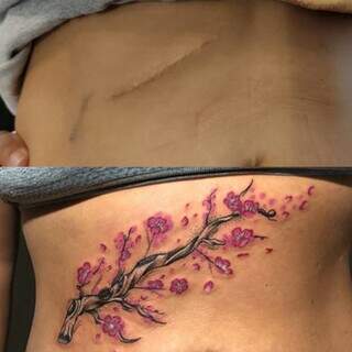 Tatuagens são desenvolvidas para cobrir cicatrizes dos clientes. (Foto: Arquivo pessoal)
