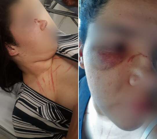 Briga deixa beb&ecirc; ferido e adolescente com nariz quebrado