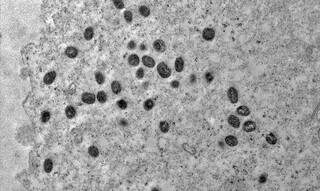 Vírus da varíola dos macacos visto em microscópio. (Foto: Fiocruz)