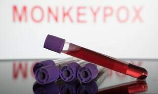 Amostra de sangue para análise de presença do vírus monkeypox. (Foto: Reprodução)