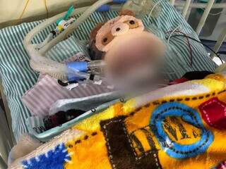 José está entubado em estado grave, no Hospital Regional em Campo Grande. (Foto: Arquivo Pessoal)