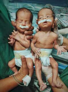 Rafael e Gabriel nasceram prematuros com 29 semanas e dois dias (Foto Arquivo pessoal)