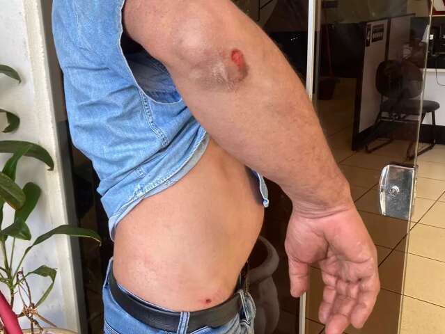 Motorista &eacute; espancado por adolescentes e tem carro levado em assalto