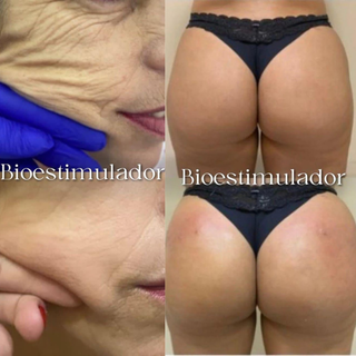 Bioestimuladores também estão com descontos (Foto: Arquivo)