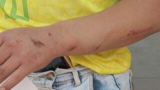 Jovem &eacute; espancado por sete pessoas ao sair de tabacaria na Capital